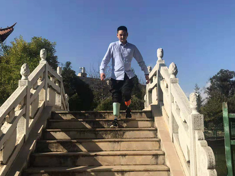 小腿假肢案例