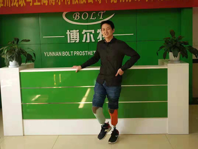 小腿假肢案例